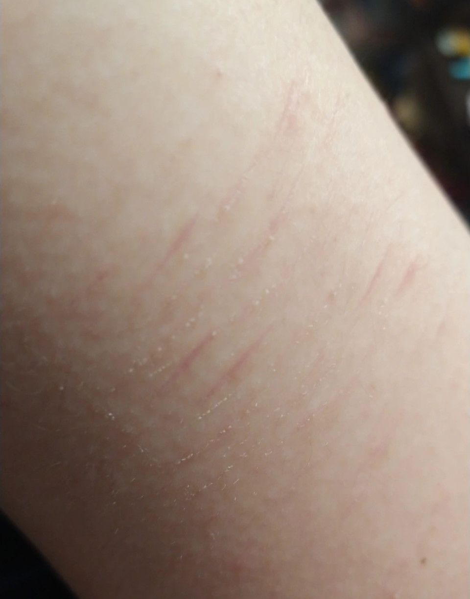 第2話 跡 写真ｱﾘ 9 18 リスカ日記 無料スマホ夢小説ならプリ小説 Bygmo