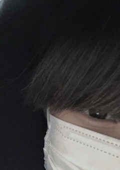 SnowManの紅一点、障害がありました。